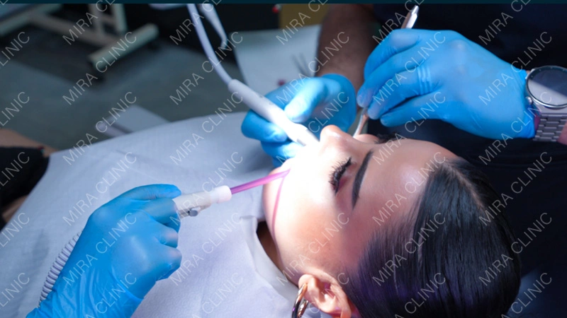  professional teeth cleaning